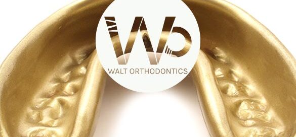 Tooth Grinding and Braces