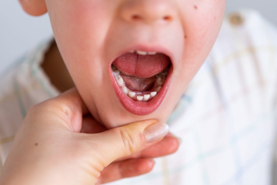 When Will My Child’s Baby Teeth Fall Out?