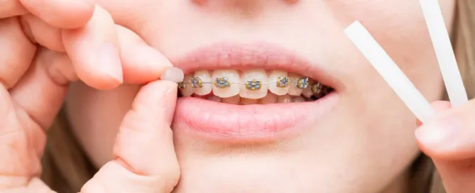 Navigating_Orthodontic_Emergencies_at_Home