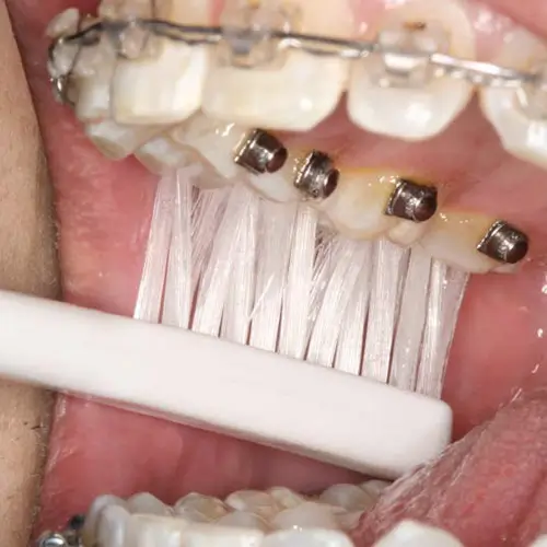 additional-care-information-brushing-five-vaughan additional-care-information-brushing-five-vaughan