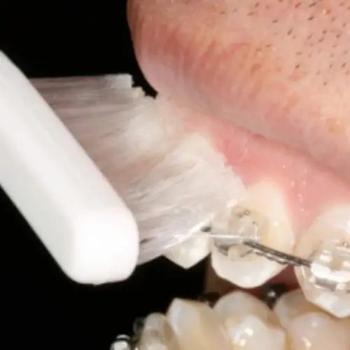 additional-care-information-brushing-one-vaughan additional-care-information-brushing-one-vaughan