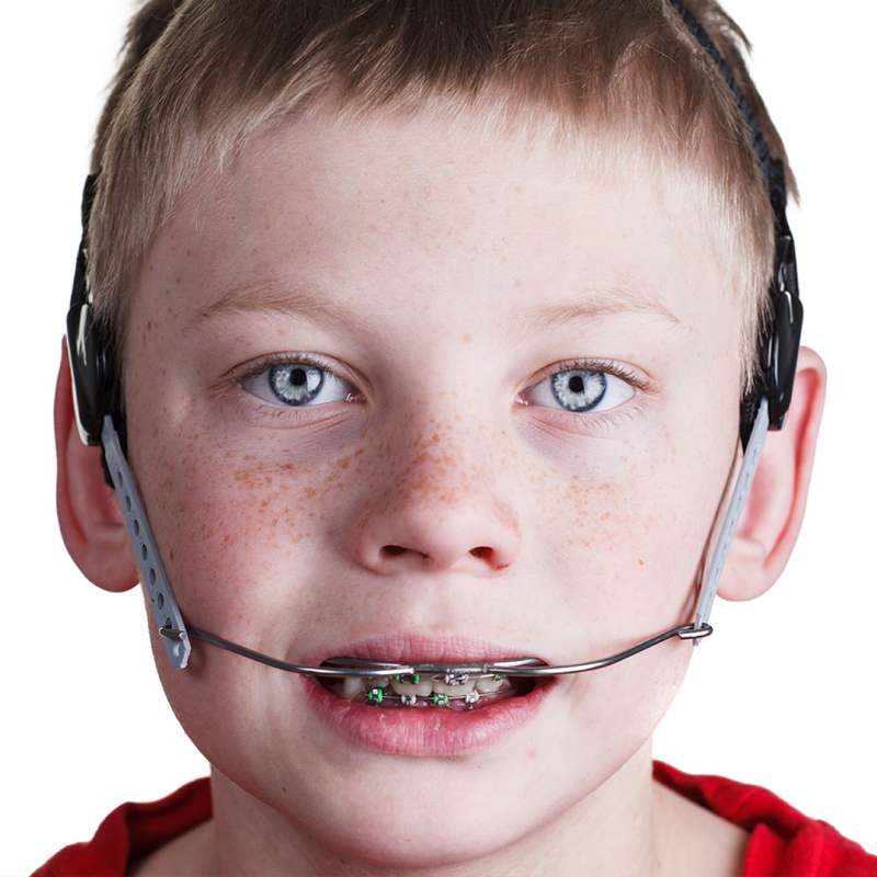 boy-with-braces-and-headgear2