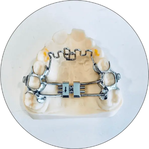 expander-with-thumb-crib expander-with-thumb-crib