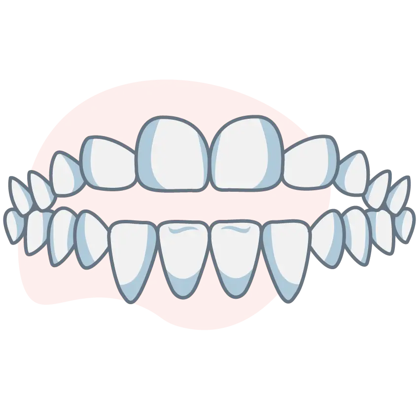 open-bite open-bite
