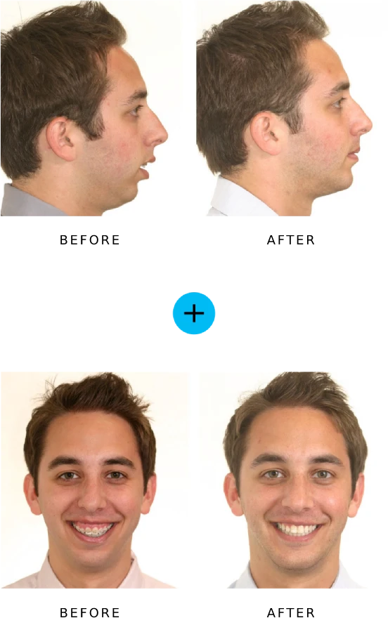orthodontist-vaughan-dr-walts-personal-experience Orthodontist Vaughan Dr Walts Personal Experience