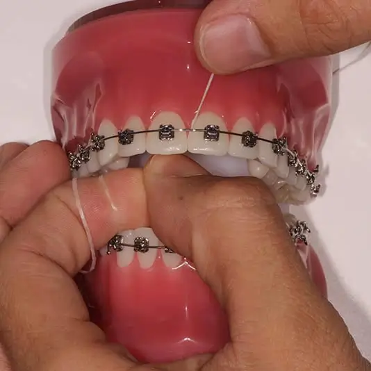 orthodontist-vaughan-flossing-with-braces-flossing-step-four Orthodontist Vaughan Flossing with Braces Flossing Step Four