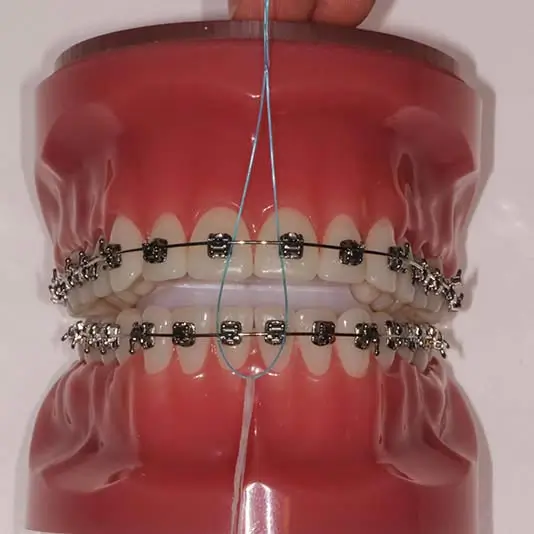 orthodontist-vaughan-flossing-with-braces-flossing-step-one Orthodontist Vaughan Flossing with Braces Flossing Step One