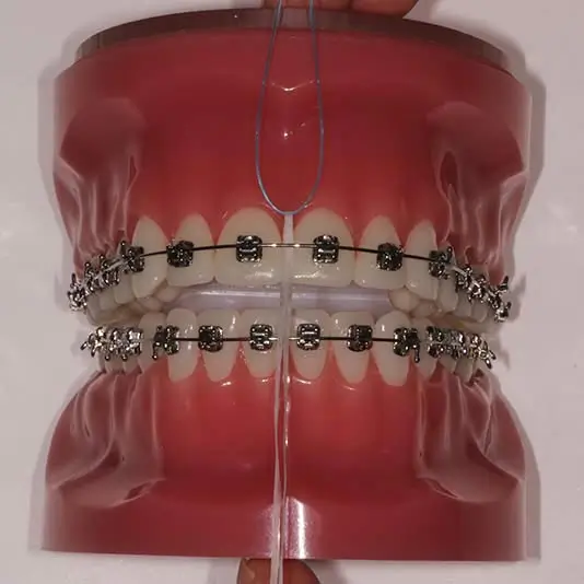 orthodontist-vaughan-flossing-with-braces-flossing-step-two Orthodontist Vaughan Flossing with Braces Flossing Step Two