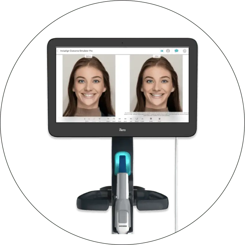Orthodontist Vaughan Itero 3d Scaner Robot