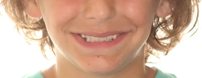 After Facial Smiling Photo
