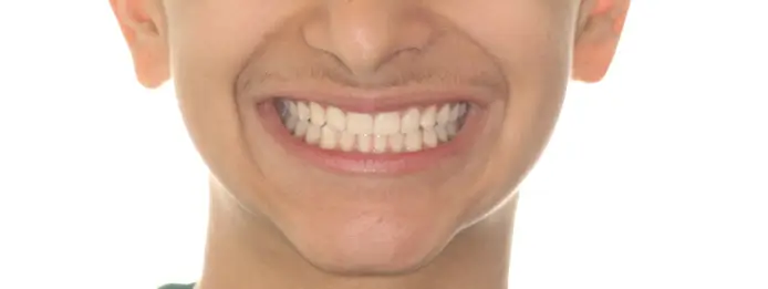 After Facial Smiling Photo