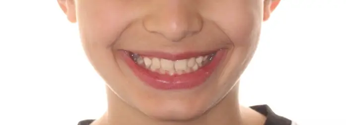 After Facial Smiling Photo