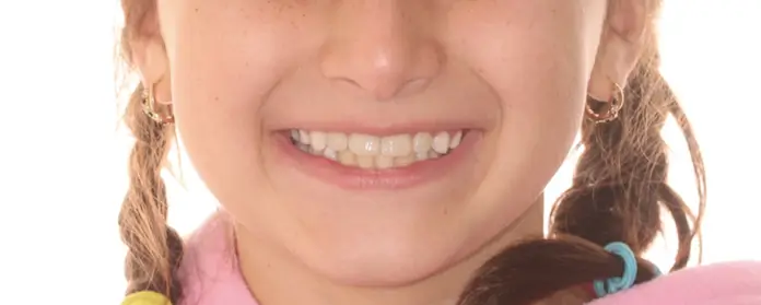 After Facial Smiling Photo
