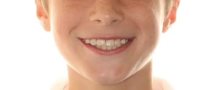 After Facial Smiling Photo