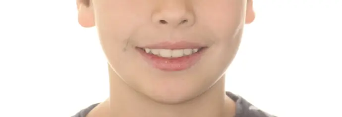 After Facial Smiling Photo
