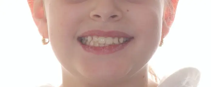 After Facial Smiling Photo