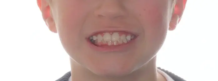 After Facial Smiling Photo