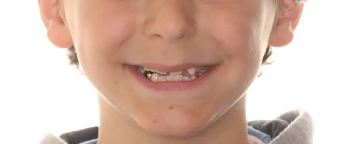 Before Facial Smiling Photo