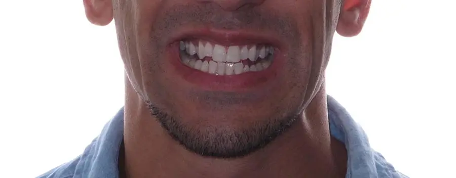 Before Facial Smiling Photo
