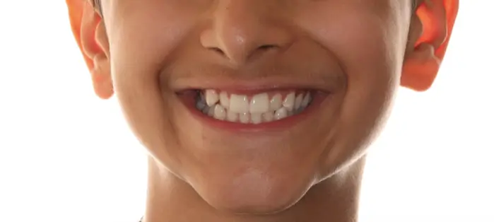Before Facial Smiling Photo