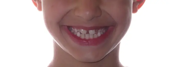 Before Facial Smiling Photo
