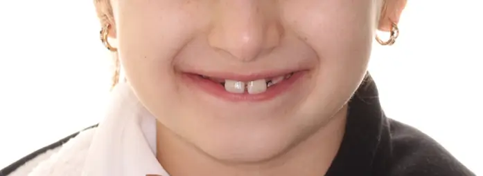 Before Facial Smiling Photo