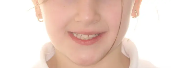 Before Facial Smiling Photo