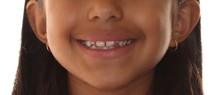 Before Facial Smiling Photo