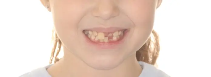 Before Facial Smiling Photo