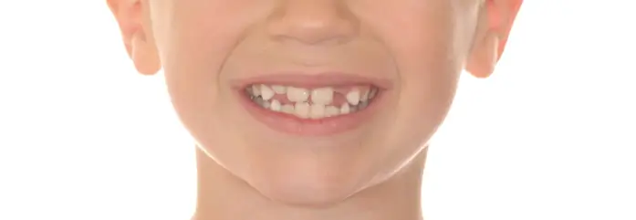 Before Facial Smiling Photo