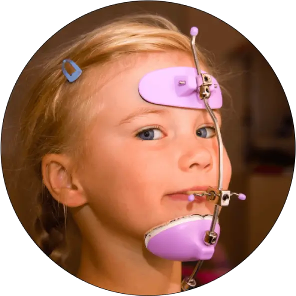 protraction-facemask protraction-facemask