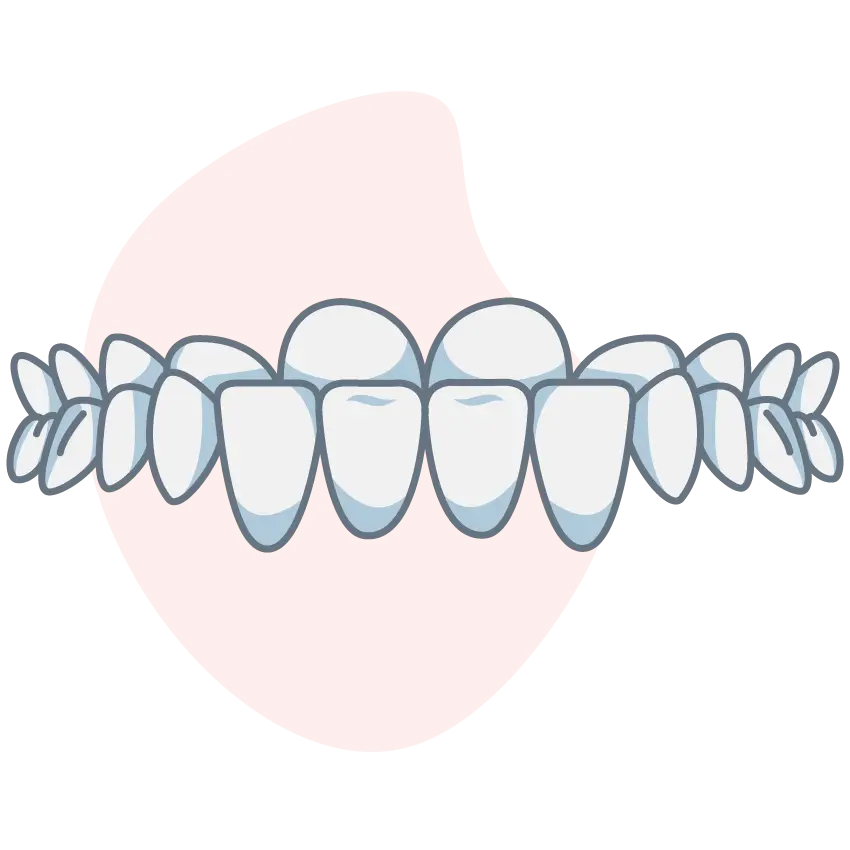 underbite underbite