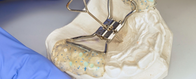 palatal-expansian-airway-vaughan-orthodontist-dr-walt