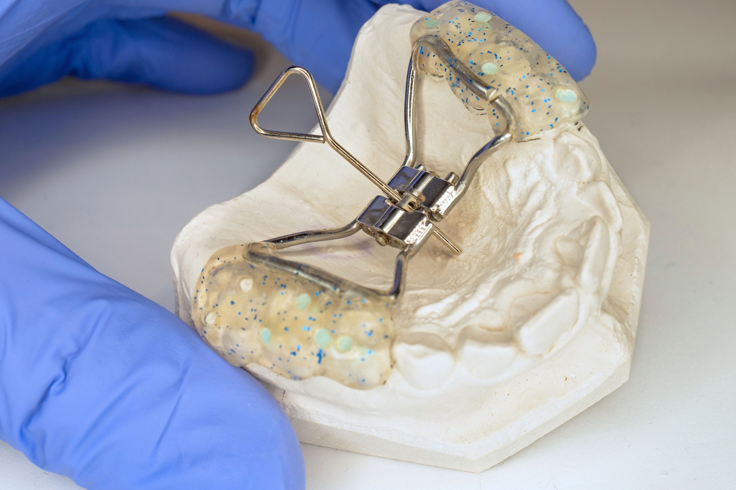 palatal-expansian-airway-vaughan-orthodontist-dr-walt