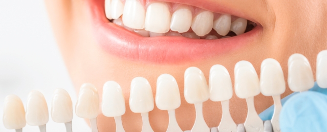Is-Teeth-Whitening Painful-Vaughan-Orthodontist