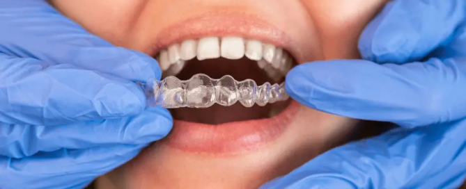 What-Is-The-Biggest-Complaint-With-Invisalign-min-Vaughan-Orthodontist