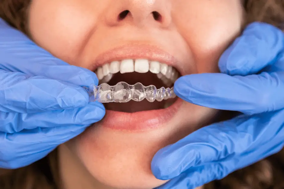 What-Is-The-Biggest-Complaint-With-Invisalign-min-Vaughan-Orthodontist