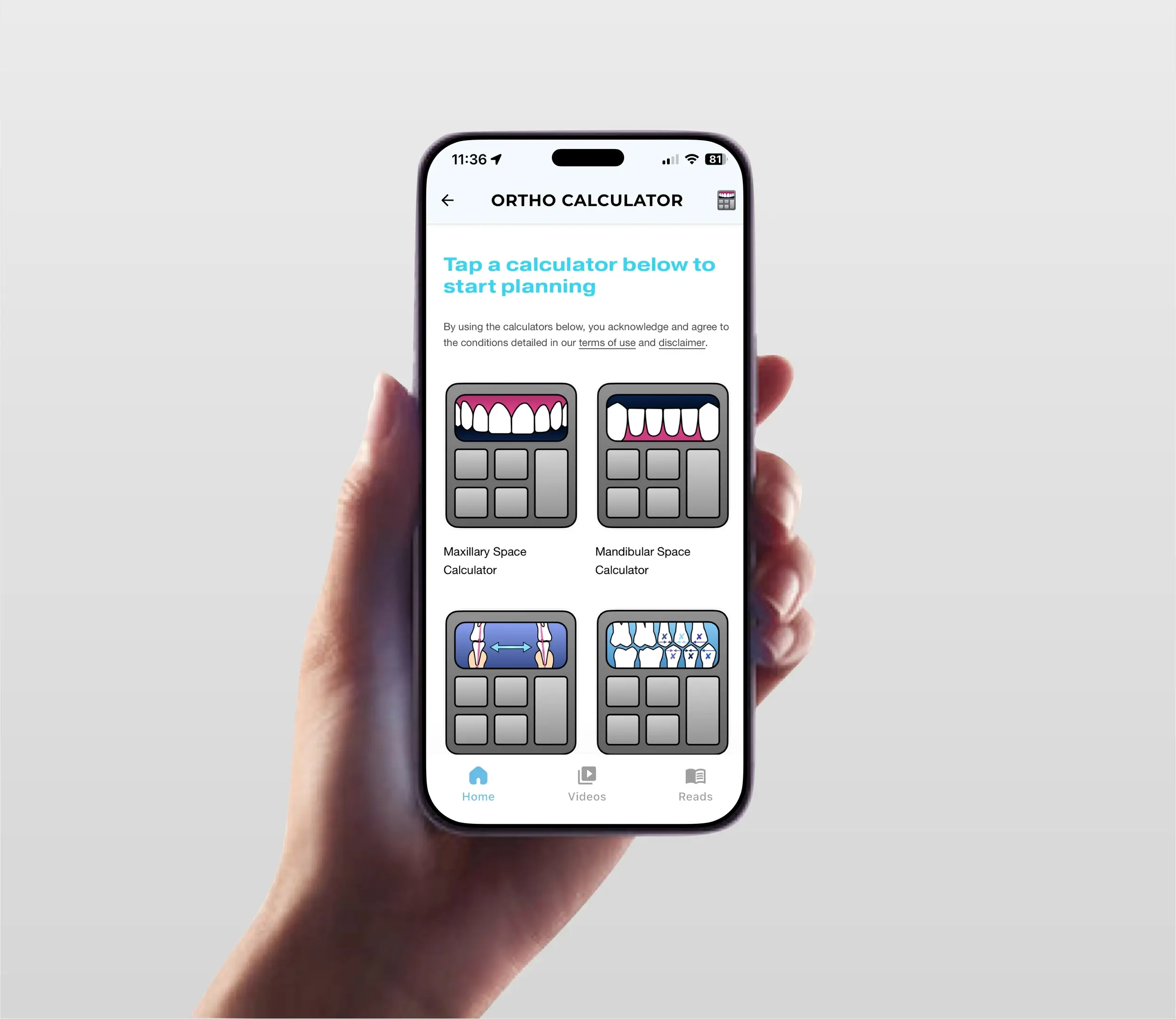 How We Use Ortho Calculator for More Precise Treatment Planning Vaughan Braces
